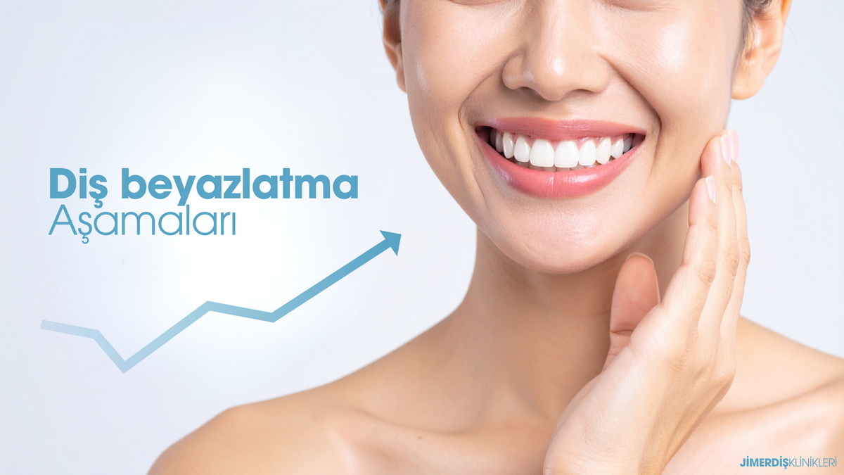 Jimer Diş Klinikleri Diş Beyazlatma Aşamaları Jimer Diş Klinikleri Diş Beyazlatma Aşamaları